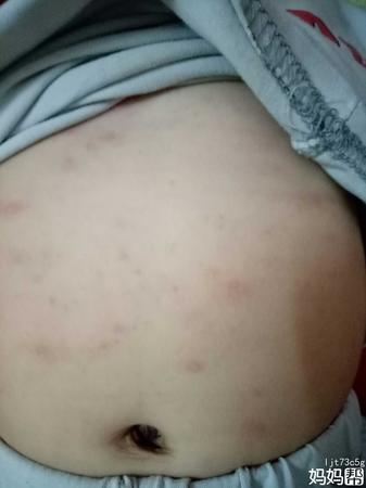 瑪咖酒過(guò)敏怎么處理(瑪卡過(guò)敏怎么處理)